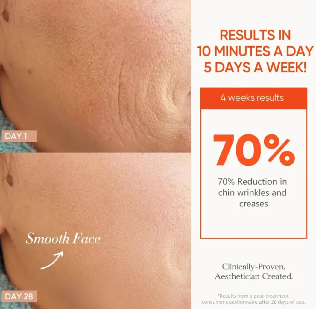 7-Color Wireless LED Therapy Face Mask